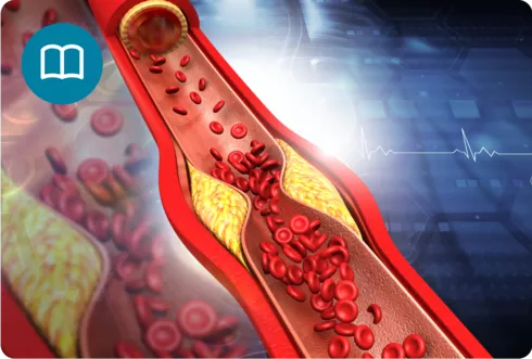 היפרכולסטרולמיה – מה זה?