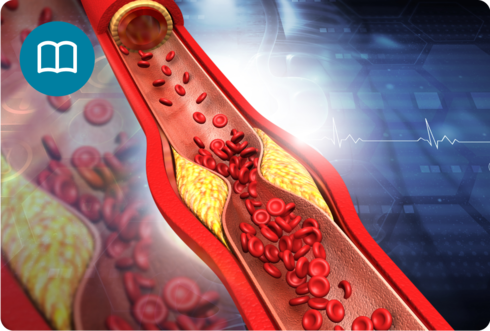 היפרכולסטרולמיה – מה זה?