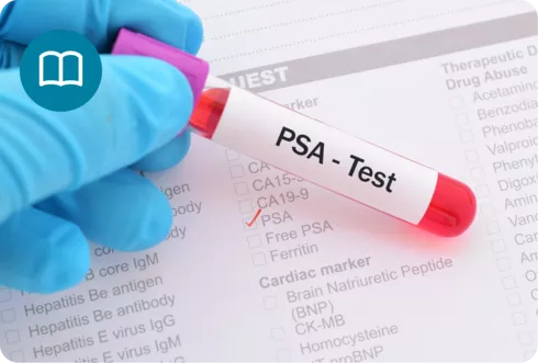 האם תמיד חייבים לטפל בסרטן הערמונית?