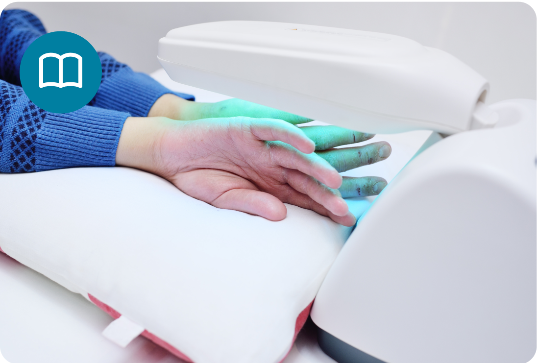 המדריך לטיפול בפסוריאזיס