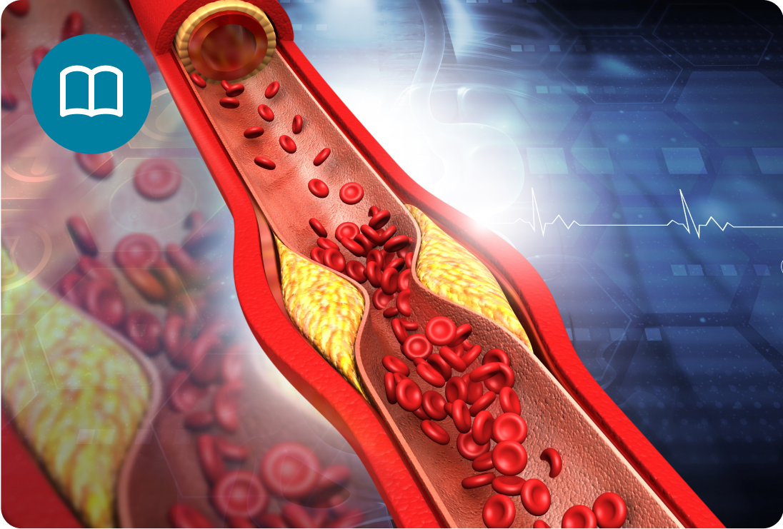 היפרכולסטרולמיה – מה זה?