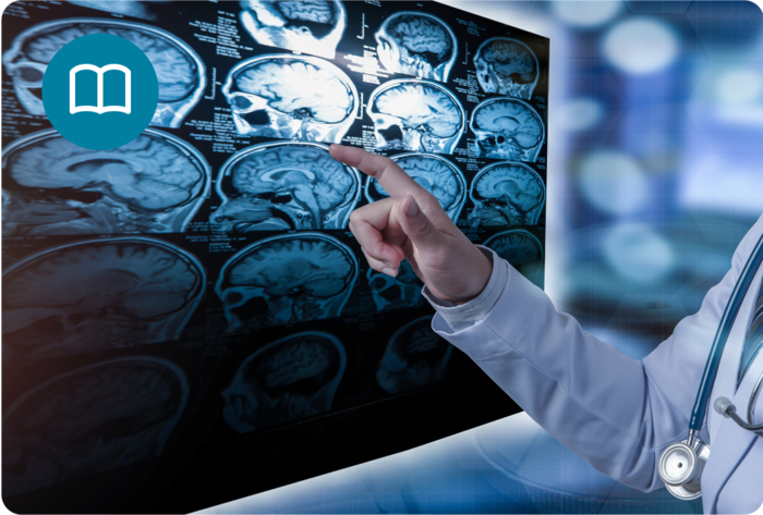 כל מה שצריך לדעת על טרשת נפוצה