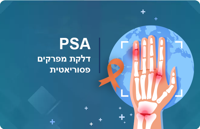 PSA-דלקת מפרקים פסוריאטית