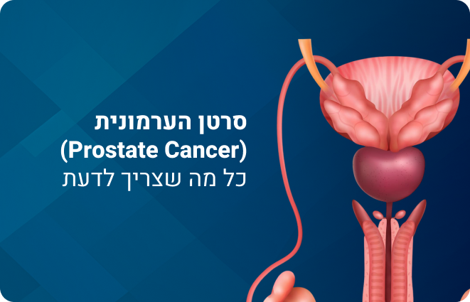 סרטן הערמונית (Prostate Cancer) כל מה שצריך לדעת