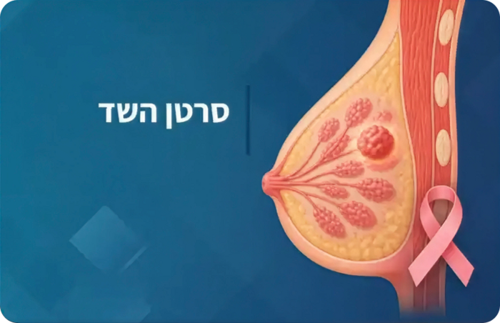 סרטן השד מעודכן 