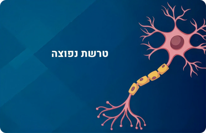 טרשת נפוצה